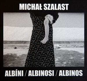 Albíni, Albinosi, Albinos