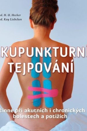Akupunkturní tejpování - Účinné při akutních i chronických bolestech a potížích