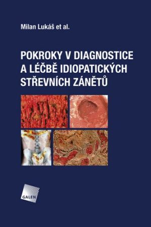 Pokroky v diagnostice a léčbě idiopatických střevních zánětů