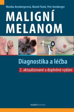 Maligní melanom - Diagnostika a léčba