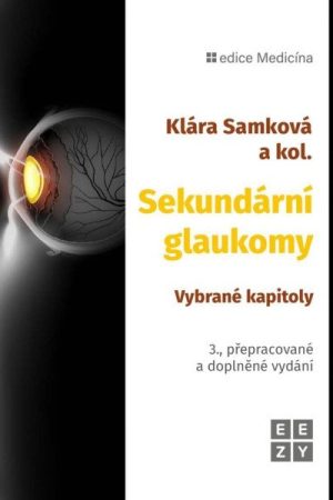 Sekundární glaukomy - Vybrané kapitoly