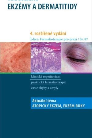 Ekzémy a dermatitidy