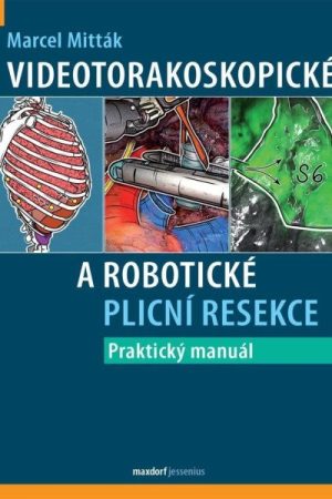 Videotorakoskopické a robotické plicní resekce