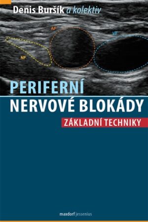 Periferní nervové blokády