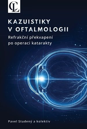 Kazuistiky v oftalmologii