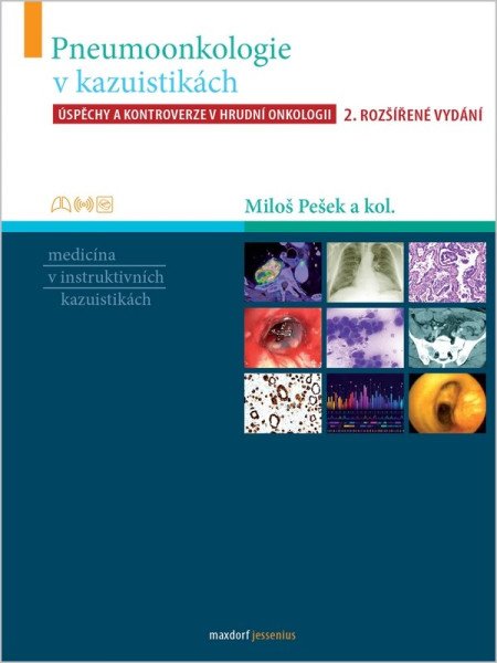 Pneumoonkologie v kazuistikách - Úspěchy a kontroverze v hrudní chirurgii
